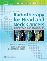 Radiotherapy for Head and Neck Cancers