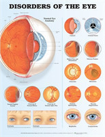 Disorders of the Eye Anatomical Chart