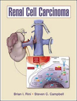 Renal Cell Carcinoma