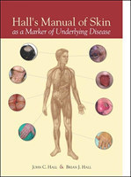 Hall's Manual of Skin as a Marker of Underlying Disease