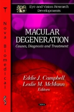 Macular Degeneration