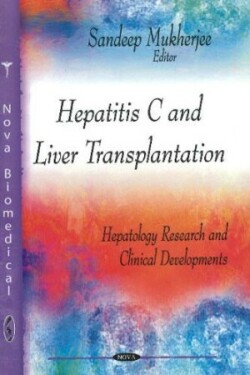 Hepatitis C & Liver Transplantation