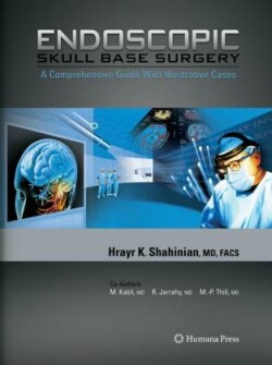 Endoscopic Skull Base Surgery