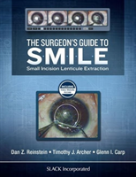 Surgeon’s Guide to SMILE