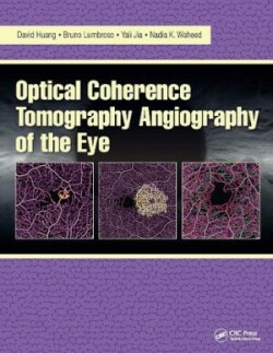 Optical Coherence Tomography Angiography of the Eye