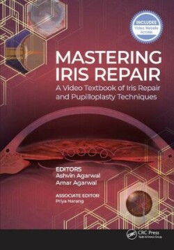 Mastering Iris Repair