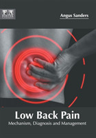 Low Back Pain: Mechanism, Diagnosis and Management