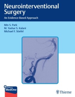 Neurointerventional Surgery