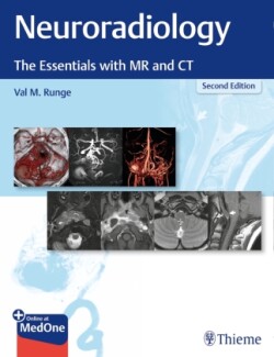 Neuroradiology