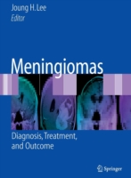 Meningiomas