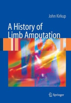 History of Limb Amputation