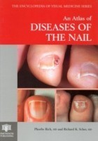 Atlas of Diseases of the Nail