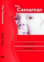 Caesarean