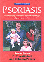 Psoriasis 2e