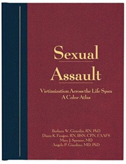 Sexual Assault