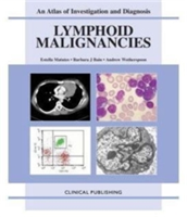 Lymphoid Malignancies