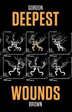 Deepest Wounds