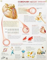 Coronary Artery Disease Chart