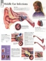 Middle Ear Infections Paper Poster