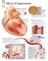 Effects of Hypertension Laminated Poster