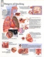 Effects of Smoking Paper Poster