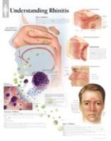 Understanding Rhinitis Paper Poster