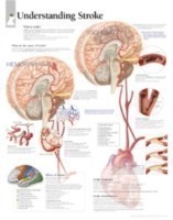 Understanding Stroke Laminated Poster