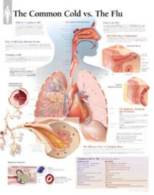 Common Cold vs the Flu Laminated Poster