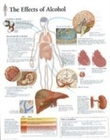 Effects of Alcohol Laminated Poster