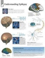 Understanding Epilepsy Paper Poster