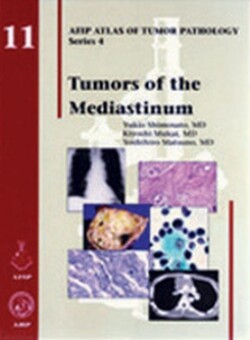 Tumors of the Mediastinum