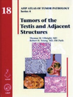 Tumors of the Testis and Adjacent Structures