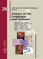 Tumors of the Esophagus and Stomach