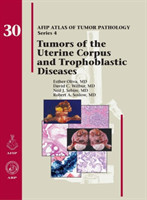 Tumors of the Uterine Corpus and Trophoblastic Diseases