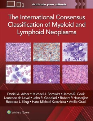 International Consensus Classification of Myeloid and Lymphoid Neoplasms