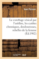Le Curettage Vésical Par l'Urèthre: Pour Cystites Chroniques, Douloureuses, Rebelles Chez La Femme