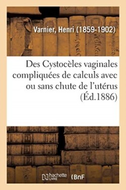 Des Cystocèles Vaginales Compliquées de Calculs Avec Ou Sans Chute de l'Utérus