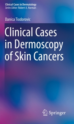 Clinical Cases in Dermoscopy of Skin Cancers