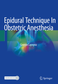 Epidural Technique In Obstetric Anesthesia