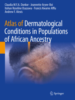 Atlas of Dermatological Conditions in Populations of African Ancestry