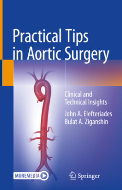 Practical Tips in Aortic Surgery