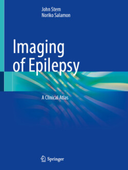 Imaging of Epilepsy