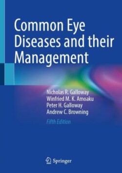 Common Eye Diseases and their Management