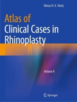 Atlas of Clinical Cases in Rhinoplasty