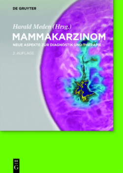 Mammakarzinom