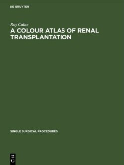 Colour Atlas of Renal Transplantation