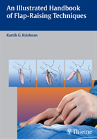 Illustrated Handbook of Flap-Raising Techniques