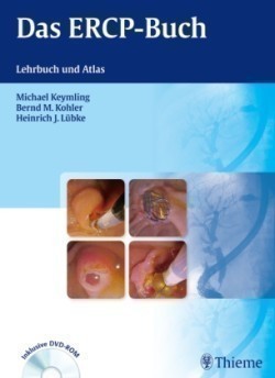 Das ERCP-Buch, m. DVD-ROM