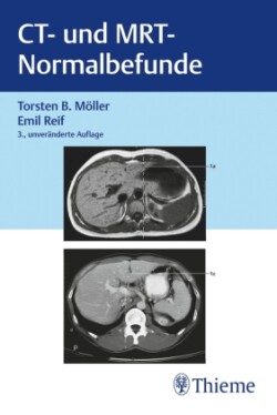 CT und MRT Normalbefunde