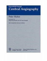 Cerebral Angiography